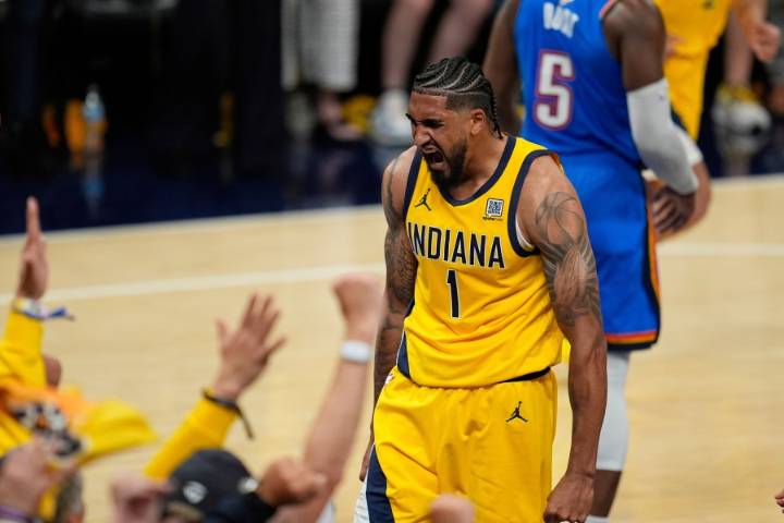Pacers' Obi Toppin to have surgery on right foot