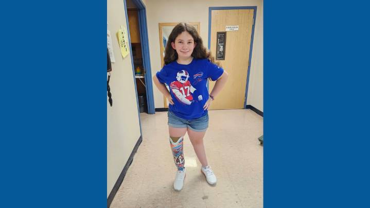 Inspirational 12-year-old Bills fan overcomes major health complication