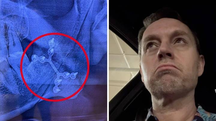 Singer Darren Hayes reveals staggering medical bills after near-death fall left him with broken jaw