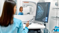 Cone Health expert explains why mammograms and early detection save lives