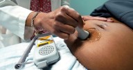 Informe de AP destaca aumento de peligros del calor para trabajadoras agrícolas embarazadas