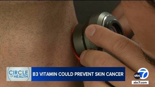 More sun-smart than sunscreen? How a simple supplement may shield your skin.