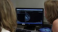 Breaking down breast cancer’s financial impact, the cost of care