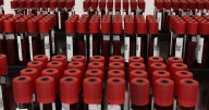 HIV and AIDS services expanded to more counties