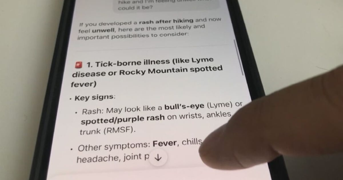 AI can be more persuasive than real doctors, even when it's wrong