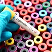 NYC health department hires influx of inspectors after Legionnaires’ outbreak