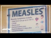 South Carolina health officials issue warning amid Upstate measles outbreak