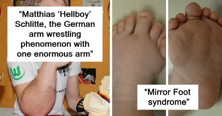 42 Photos Of Human Body Quirks That Are Both Fascinating And Shocking