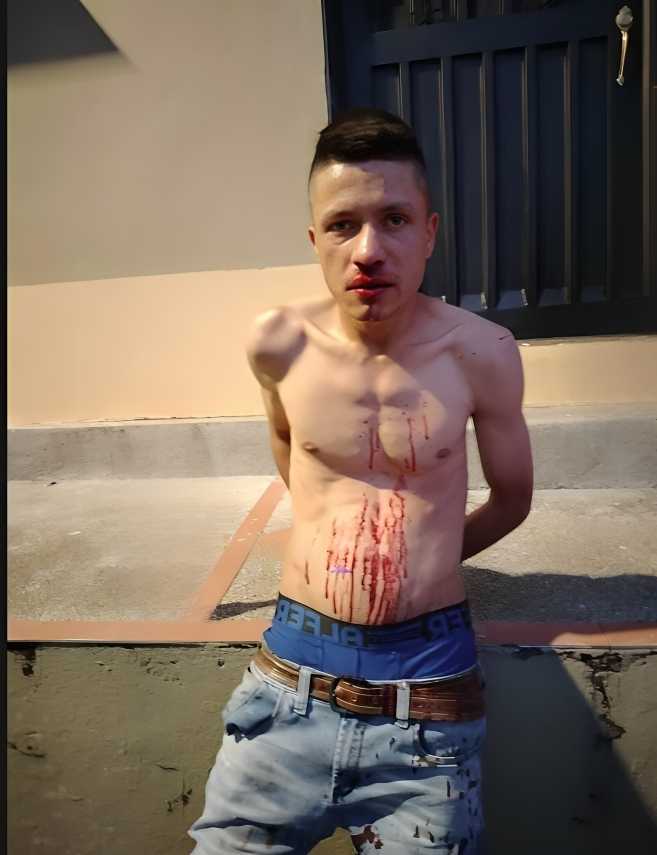 Lo agredió con cuchillo - EXTRA | El Diario de Todos