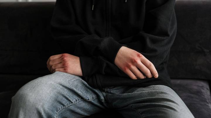 Brutal paliza a joven (24) con 70% de discapacidad que sus agresores difunden en redes: "Tiene pánico a salir de casa"