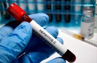 Hepatitis C: causas, síntomas, diagnóstico y tratamiento de esta enfermedad curable