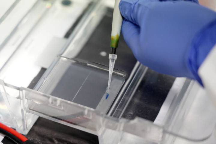 El fallo en el cribado de cáncer de mama en Andalucía afecta a 2.000 mujeres