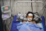 A bomb in Gaza's rubble wounds twins who thought it was a toy