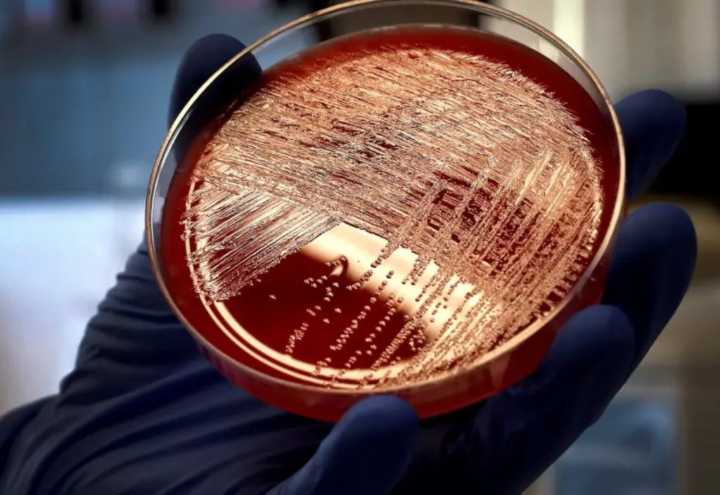 Brote de listeria en EE.UU. deja seis muertos