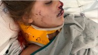Center Line girl badly injured when speeding motorist crashes into her bedroom