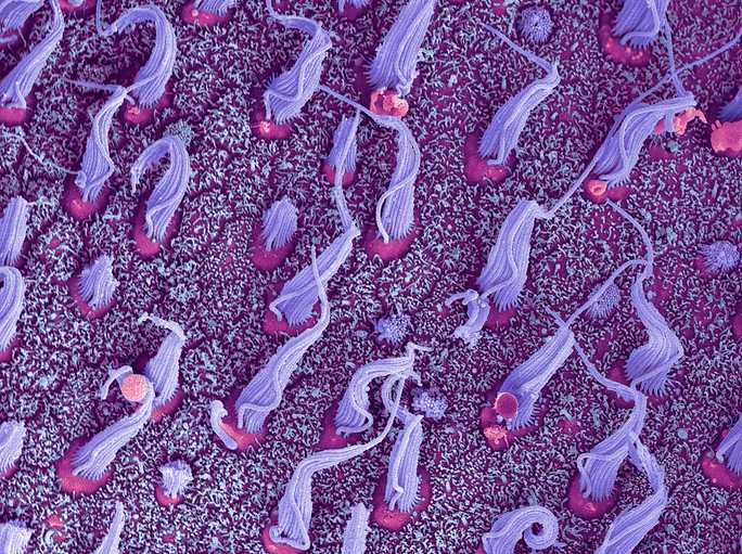 Make Waves: Inside the Gene Therapy Bringing Natural Hearing to Deaf Children