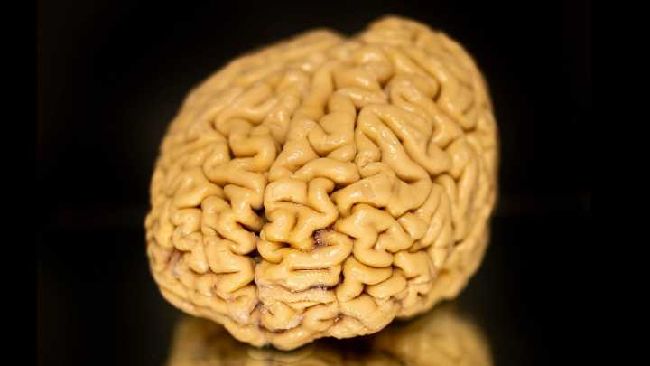 'Superager' Brains Defy Cognitive Decline. We Finally Know Their Secret.