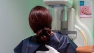 Sanidad reclama a la Junta de Andalucía todos los informes sobre el cribado de cáncer de mama para "evaluar su impacto"