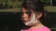 'I watched the dog take her face off': Mentor mom, 4-year-old daughter recovering following attack by pit bull