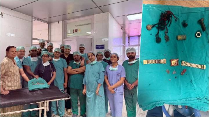 Doctors Of Jaipur's SMS Hospital Remove Watch, Iron Nails From Patient's Abdomen