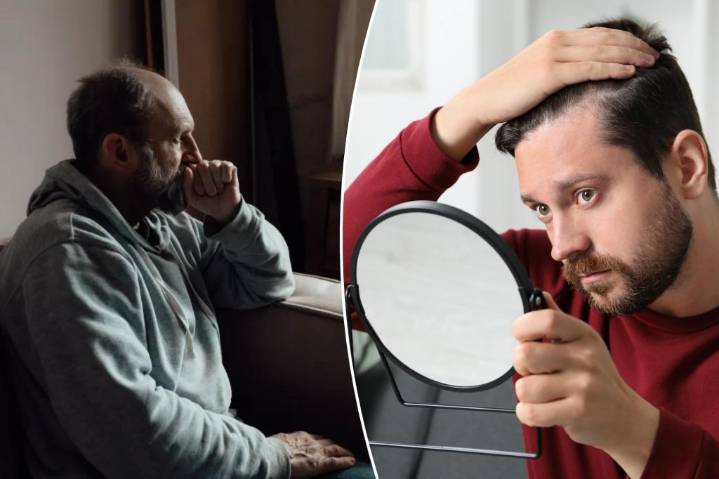 Hair loss treatment used by millions linked to suicide risk