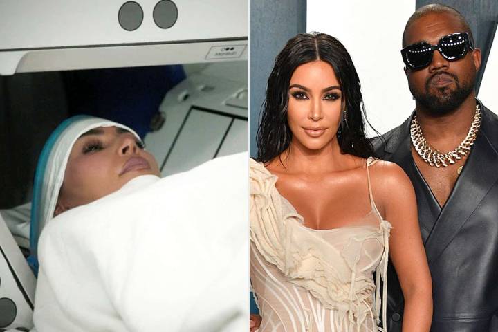 Kim Kardashian Reveals She Was Diagnosed with a Brain Aneurysm