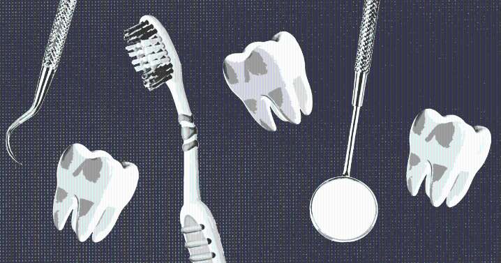 The Best Time To Whiten Your Teeth, According to Dentists