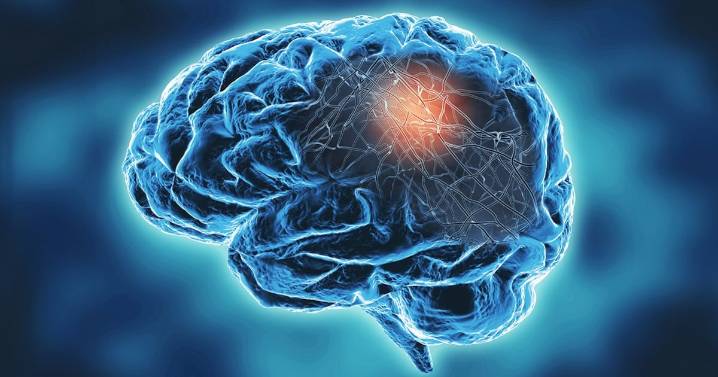 Hay tantos enfermos de Alzheimer en NL que se llenarían el Estadio de Tigres o el BBVA