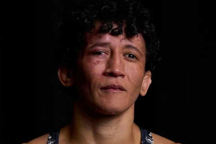 What Happened to Virna Jandiroba’s Eye? All We Know About UFC Star’s Condition