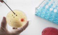 Targeted steroid use shows promise against TB