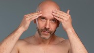 Los calvos necesitan champú: cómo cuidar el cuero cabelludo, según la dermatóloga
