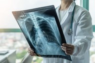 Cáncer en la región. Por qué la escasez de fondos para los planes nacionales puede poner en riesgo la detección precoz