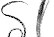 DOH: Rat lungworm disease confirmed in adult on Kauai