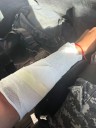 Cuatro policías heridos en operativos policiales en barrios Villa Corina y Santa Isabel Anexo