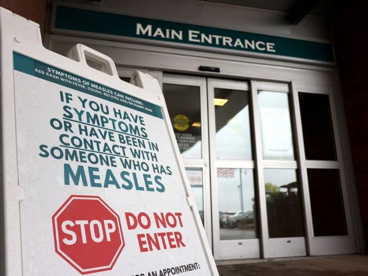 Canada is on the verge of losing its measles