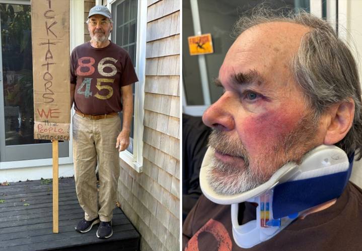 ‘I thought I might get killed’: 77-year-old man attacked while leaving ‘No Kings’ protest in Hyannis