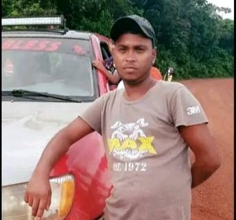 Piden justicia por una venezolana que perdió la pierna tras un choque en Guyana
