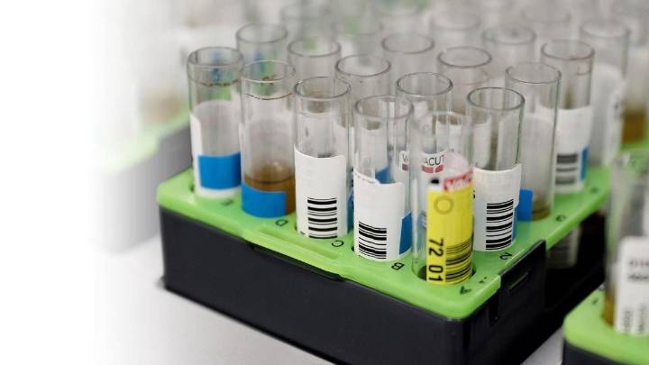 Madrid detecta el primer contagio autóctono de la variante más grave de la viruela del mono