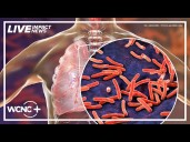 Novant Health provides updates after tuberculosis case reported in Charlotte