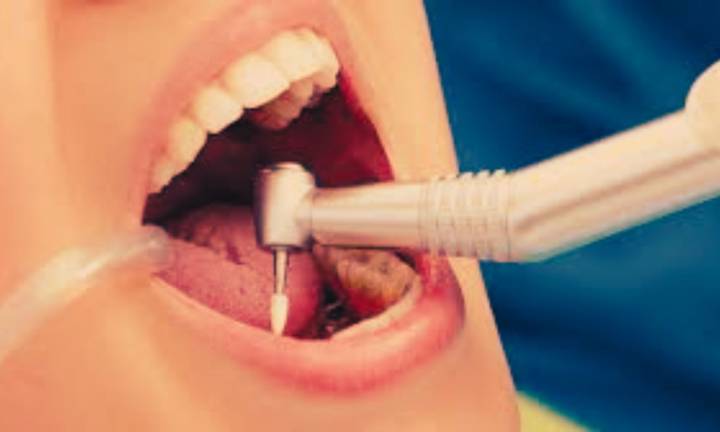 MA-T Shows Potential as Safer, Effective Root Canal Irrigant compared to sodium hypochlorite: Study