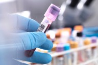 Can a new blood test really detect ME/CFS? An expert unpacks new research