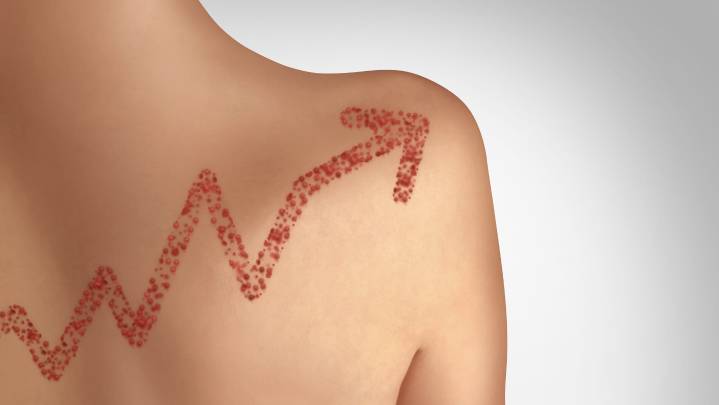 Over 150 unvaccinated SC students quarantine to reduce measles exposure