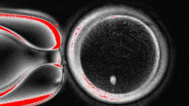Investigadores convierten células de piel humana en óvulos, pero aún no son viables
