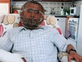 Una insólita estrategia para dejar de fumar: se puso una jaula en la cabeza