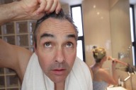The newest side effect of hair loss
