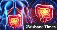 TGA backs NeuroScientific stem cell assault on Crohn’s disease