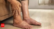 Pancreatic cancer: 4 warning signs in your legs that you shouldn't ignore