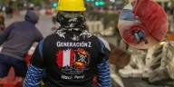 Herido por perdigones en protesta de la Generación Z: CNDDHH alerta y exige intervención de la Fiscalía