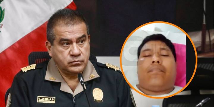 Luis Magallanes se defiende y apunta contra Óscar Arriola: “Disparé al suelo, sin investigar me inculpan”