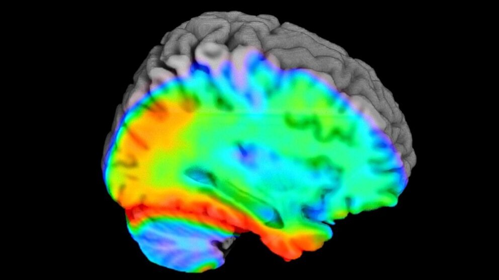 Opinion: Stigma around Alzheimer’s delays treatment in Latino community